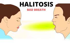 Read more about the article Banishing Bad Breath: Effective Treatment and Prevention Strategies