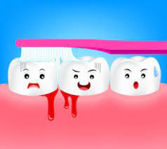 Read more about the article Effective Bleeding Gums Treatment: Causes, Prevention, and Solutions